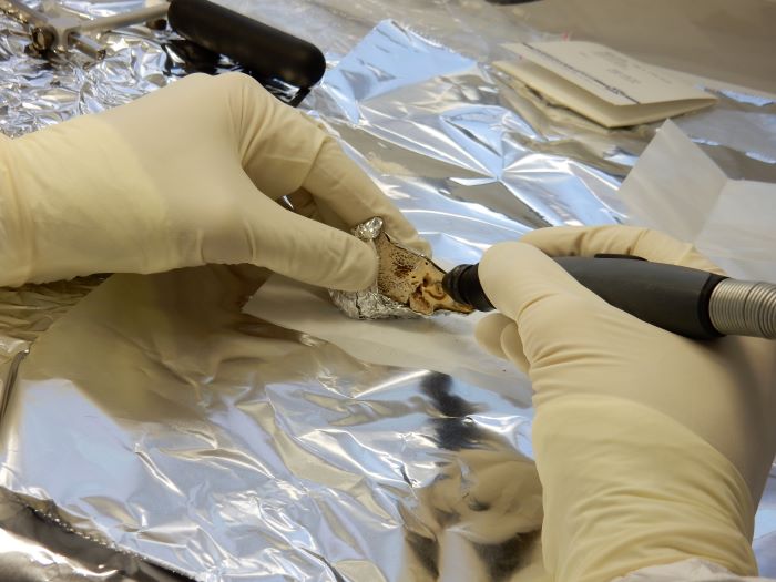 Drilling of bone material with a dental drill.